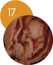 Ecografía 5D en la semana 17 de embarazo