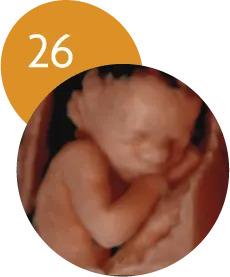 Ecografía 5D en la semana 26 de embarazo
