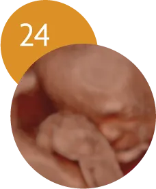Ecografía 5D en la semana 24 de embarazo