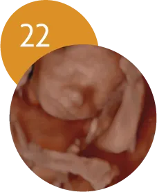 Ecografía 5D en la semana 22 de embarazo