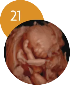 Ecografía 5D en la semana 21 de embarazo