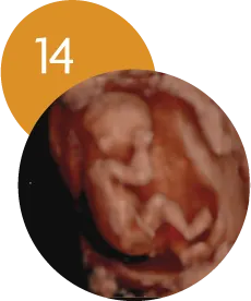 Ecografía 5D en la semana 14 de embarazo
