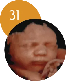Ecografía 5D en la semana 31 de embarazo