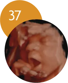 Ecografía 5D en la semana 37 de embarazo