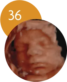 Ecografía 5D en la semana 36 de embarazo
