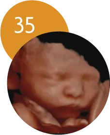 Ecografía 5D en la semana 35 de embarazo