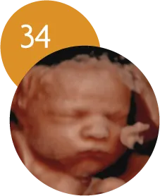 Ecografía 5D en la semana 34 de embarazo