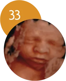 Ecografía 5D en la semana 33 de embarazo