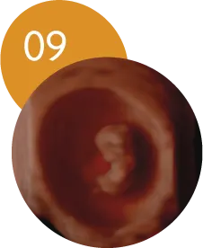 Ecografía 5D en la semana 9 de embarazo