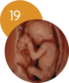 Ecografía 5D en la semana 19 de embarazo